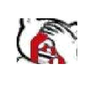 DNF阿修罗一觉插画改捂脸表情补丁绿色版